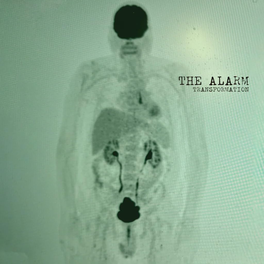 The Alarm - Transformation [Vinyl] 1