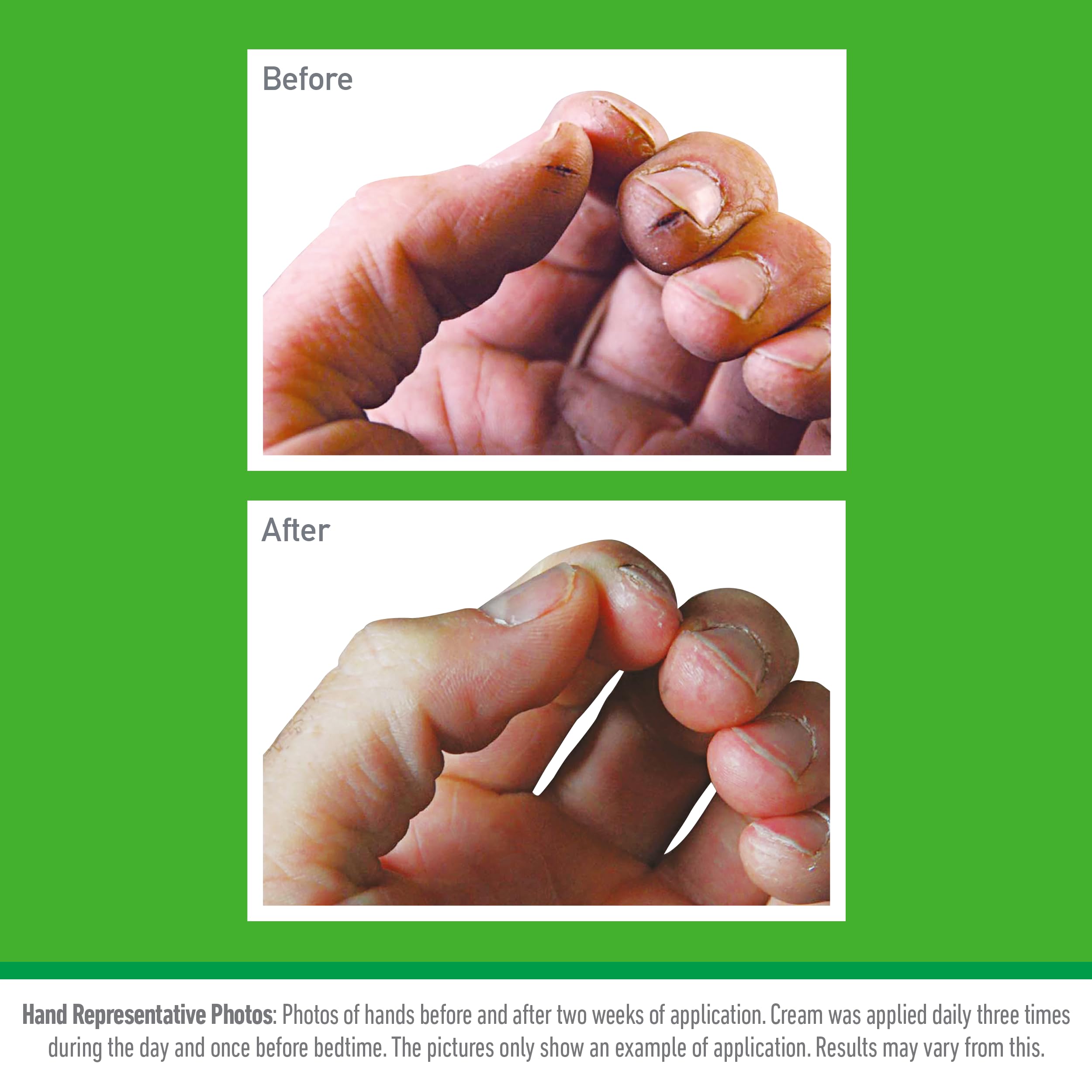 O'Keeffe's Working Hands Hand Cream (193g x 2 Pack) - Non-Greasy Moisturizer for Dry, Cracked Skin 2