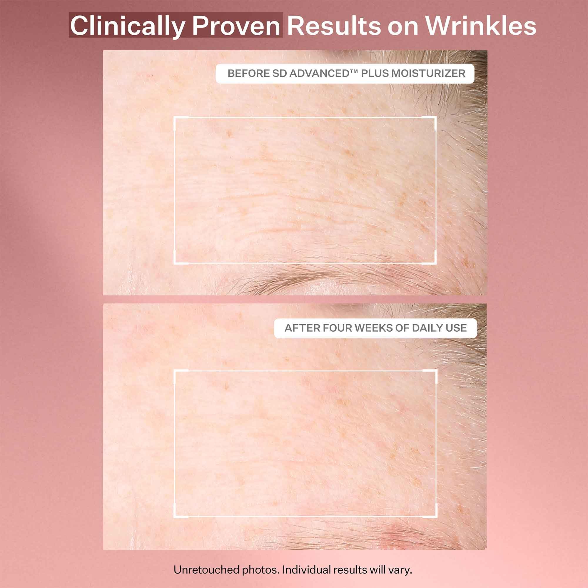 StriVectin SD Advanced Plus Intensive Moisturizer for Wrinkles & Stretchmarks | 120 ml | Unisex Adult 5