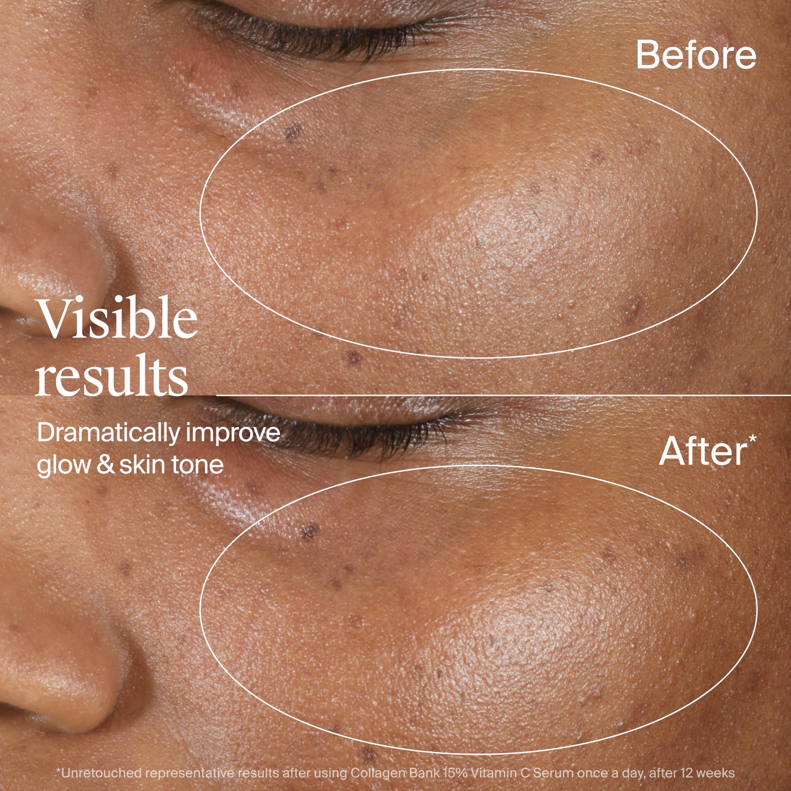 Neutrogena Collagen Bank Vitamin C Serum - 15% Pure Vitamin C, 15ml | Dermatologist Developed 7